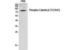 Western Blot (WB) analysis of specific cells using Phospho-Catenin-beta (T41/S45) Polyclonal Antibody. (beta Catenin anticorps  (pSer45, pThr41))