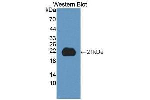 Detection of Recombinant ITGb8, Human using Polyclonal Antibody to Integrin Beta 8 (ITGb8) (ITGB8 anticorps  (AA 471-629))