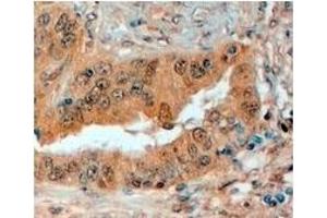 AP23772PU-N SEMA3E antibody staining of Paraffin Embedded Human Prostate at 4 µg/ml. (SEMA3E anticorps  (Internal Region))