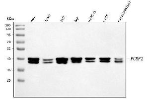 Western blot analysis of hnRNP E2/PCBP2 using anti-hnRNP E2/PCBP2 antibody (ABIN7599983).