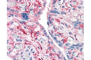 Anti-CD26 antibody IHC of human placenta. (DPP4 anticorps  (Internal Region))