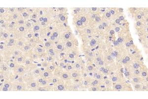 Detection of CARNS1 in Mouse Liver Tissue using Polyclonal Antibody to Carnosine Synthase 1 (CARNS1) (CARNS1 anticorps  (AA 623-826))