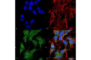 Immunocytochemistry/Immunofluorescence analysis using Rabbit Anti-UVRAG Polyclonal Antibody . (UVRAG anticorps  (C-Term) (FITC))