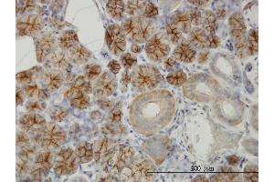 Immunoperoxidase of monoclonal antibody to RHCG on formalin-fixed paraffin-embedded human salivary gland. (RHCG anticorps  (AA 418-479))