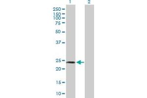 Western Blot analysis of SPA17 expression in transfected 293T cell line by SPA17 MaxPab polyclonal antibody.