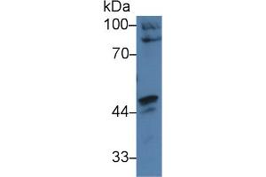 Western blot analysis of Human HepG2 cell lysate, using Human CARD9 Antibody (3 µg/ml) and HRP-conjugated Goat Anti-Rabbit antibody (