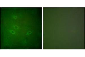 Immunofluorescence analysis of HeLa cells, using CARD6 antibody. (CARD6 anticorps  (N-Term))