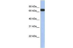 WB Suggested Anti-GNL3L Antibody Titration: 0. (GNL3L anticorps  (N-Term))