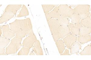 Detection of ITIH3 in Human Skeletal muscle Tissue using Polyclonal Antibody to Inter Alpha-Globulin Inhibitor H3 (ITIH3)