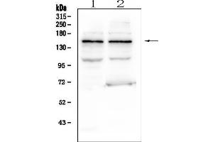 Western blot analysis of KCNH2 using anti-KCNH2 antibody (ABIN6719413).