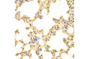 Immunohistochemistry (IHC) image for anti-Proteasome Subunit alpha Type 1 (PSMA1) (AA 1-263) antibody (ABIN3016184)
