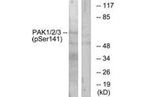 Western blot analysis of extracts from mouse brain, using PAK1/2/3 (Phospho-Ser144/141/139) Antibody. (PAK1/2/3 anticorps  (pSer144))