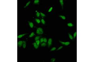 Immunofluorescence staining of Hela cells with ABIN7145812 at 1:200, counter-stained with DAPI. (BRD4 anticorps  (AA 150-200))