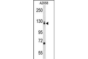 Western blot analysis of EFTUD2 Antibody (Center) (ABIN653236 and ABIN2842767) in  cell line lysates (35 μg/lane).