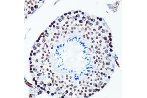 Immunohistochemistry of paraffin-embedded mouse testis using Phospho-Histone H2AX-S139 antibody (ABIN6135258, ABIN6136140, ABIN6136141 and ABIN7101881) at dilution of 1:100 (40x lens).