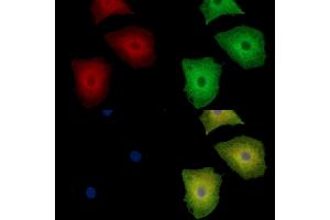 anti-WASH Complex Subunit 5 (WASHC5) antibody