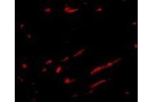 Immunofluorescence of Slc22A17 in rat kidney tissue cells with this product at 20 μg/ml.