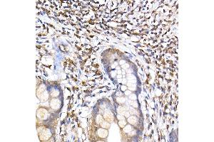 Immunohistochemistry of paraffin-embedded human small intestine using TR Rabbit mAb (ABIN7270870) at dilution of 1:200 (40x lens). (TRAPPC2 anticorps)