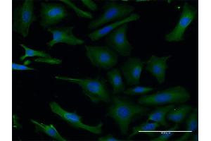 Immunofluorescence of monoclonal antibody to PAFAH1B1 on HeLa cell.