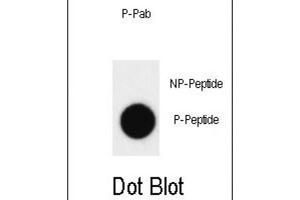 Dot Blot (DB) image for anti-C-Abl Oncogene 1, Non-Receptor tyrosine Kinase (ABL1) (pTyr412) antibody (ABIN3001744) (ABL1 anticorps  (pTyr412))