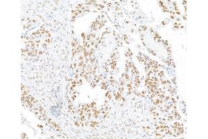 Immunohistochemistry (IHC) image for anti-Regulatory Factor X, 1 (Influences HLA Class II Expression) (RFX1) (AA 929-979) antibody (ABIN7454894)