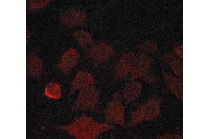 ABIN6269146 staining A549 cells by ICC/IF.