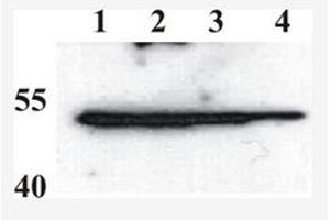 Western Blotting (WB) image for anti-BPV-1 (AA 208-218) antibody (ABIN781764) (BPV-1 (AA 208-218) anticorps)