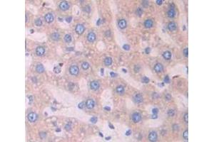 IHC-P analysis of Kidney tissue, with DAB staining. (Surfactant Protein C anticorps  (AA 1-194))