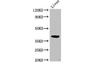 Western Blot Positive WB detected in: Rat liver tissue All lanes: ADH5 antibody at 2 μg/mL Secondary Goat polyclonal to rabbit IgG at 1/50000 dilution Predicted band size: 40 kDa Observed band size: 40 kDa (ADH5 anticorps  (AA 14-130))