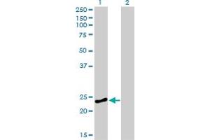 Western Blot analysis of RAB4A expression in transfected 293T cell line by RAB4A monoclonal antibody (M01), clone 1C10.