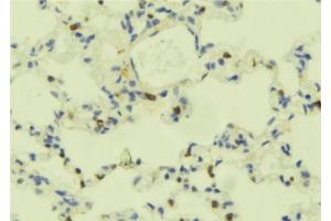 ABIN6273695 at 1/100 staining Mouse lung tissue by IHC-P. (PLCE1 anticorps)