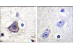 Immunohistochemistry analysis of paraffin-embedded human brain, using HER3 (Phospho-Tyr1222) Antibody.