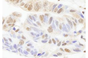 Immunohistochemistry (IHC) image for anti-Poly (ADP-Ribose) Polymerase 1 (PARP1) (AA 50-100) antibody (ABIN7448996) (PARP1 anticorps  (AA 50-100))