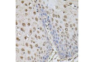 Immunohistochemistry of paraffin-embedded human esophagus using CCNA2 antibody.