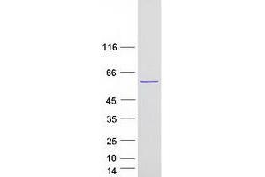 Validation with Western Blot