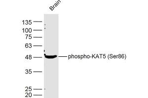 Mouse brain lysates probed with KAT5 (Ser86) Polyclonal Antibody, Unconjugated  at 1:300 dilution and 4˚C overnight incubation.