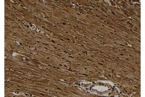 ABIN6278650 at 1/100 staining Rat heart tissue by IHC-P. (CSNK1A1 anticorps  (pTyr294))