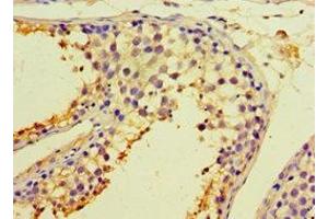 anti-Calreticulin 3 (CALR3) (AA 135-384) antibody