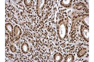 IHC-P Image PSME3 antibody detects PSME3 protein at nucleus in mouse cervix by immunohistochemical analysis. (PSME3 anticorps)