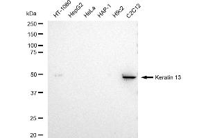 Western blotting analysis using Keratin 13 antibody (ABIN7799165).