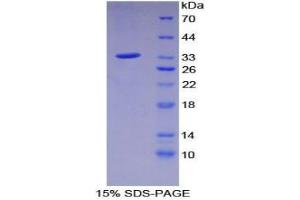 SDS-PAGE analysis of Mouse C2CD3 Protein. (C2CD3 Protéine)