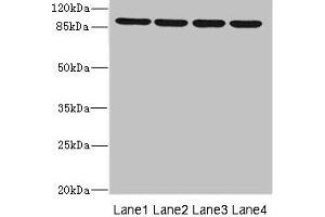 Western blot All lanes: ITGB8 antibody at 1.