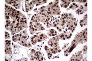 Image no. 4 for anti-Nibrin (NBN) (AA 183-460) antibody (ABIN1491058)