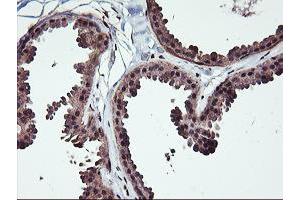 Immunohistochemical staining of paraffin-embedded Human breast tissue using anti-NHEJ1 mouse monoclonal antibody. (NHEJ1 anticorps)