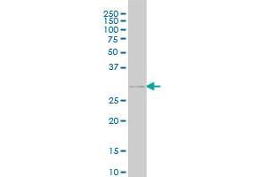 GSC monoclonal antibody (M03), clone 3D11 Western Blot analysis of GSC expression in COLO 320 HSR .