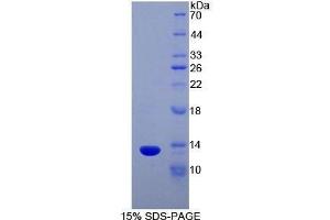 SDS-PAGE (SDS) image for Chemokine (C Motif) Ligand 1 (XCL1) (AA 27-107) protein (His tag,T7 tag) (ABIN1878688)