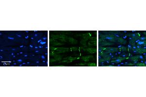 Rabbit Anti-PERP Antibody   Formalin Fixed Paraffin Embedded Tissue: Human heart Tissue Observed Staining: Plasma membrane in intercalated disk Primary Antibody Concentration: 1:100 Other Working Concentrations: 1:600 Secondary Antibody: Donkey anti-Rabbit-Cy3 Secondary Antibody Concentration: 1:200 Magnification: 20X Exposure Time: 0. (PERP anticorps  (Middle Region))