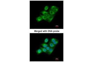 ICC/IF Image Immunofluorescence analysis of paraformaldehyde-fixed A549, using Factor XIIIa, antibody at 1:200 dilution.
