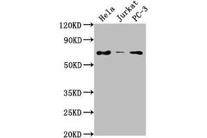 Western Blot Positive WB detected in: Hela whole cell lysate, Jurkat whole cell lysate, PC-3 whole cell lysate All lanes: PRICKLE3 antibody at 1:2000 Secondary Goat polyclonal to rabbit IgG at 1/50000 dilution Predicted band size: 69, 60 kDa Observed band size: 69 kDa