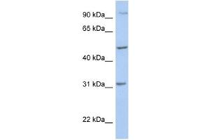 PPM1J antibody used at 1 ug/ml to detect target protein.